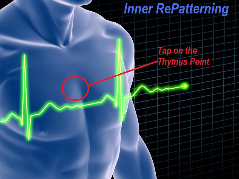 Picture showing the thymus tapping point used in Inner RePatterning